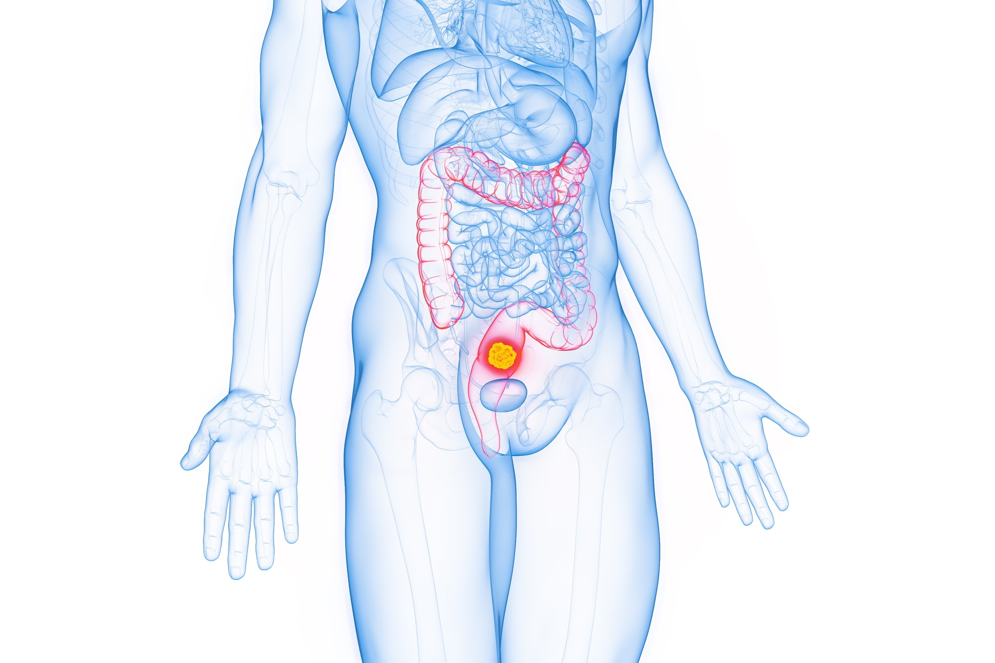 (c) 2022 Sebastian Kaulitzki/Shutterstock