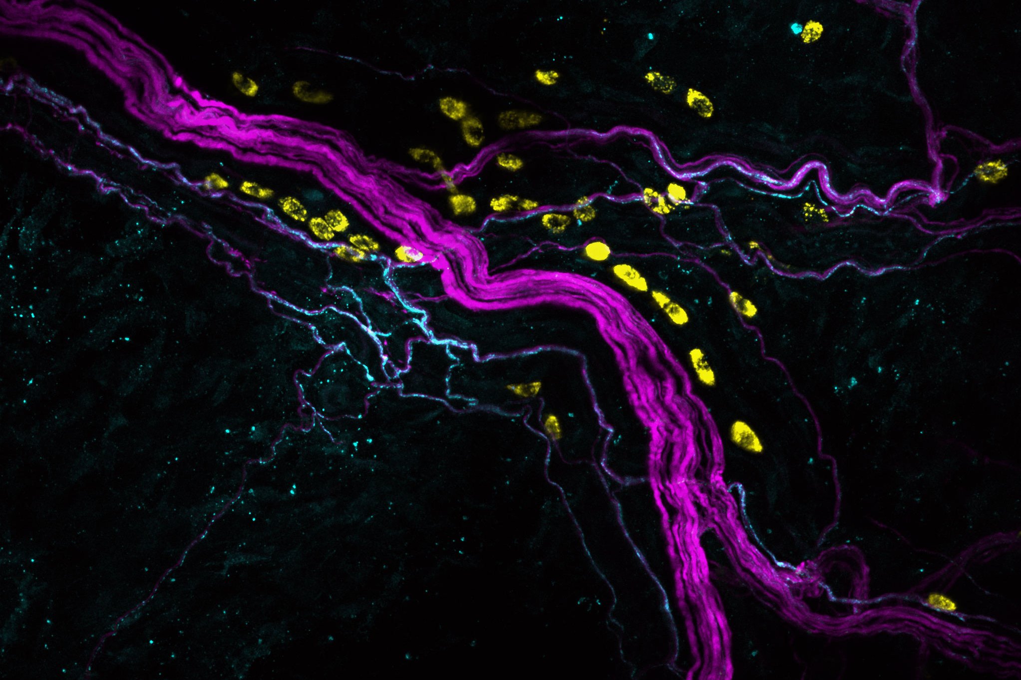 (c) R. Jain/S.Tikoo/MedUni Wien