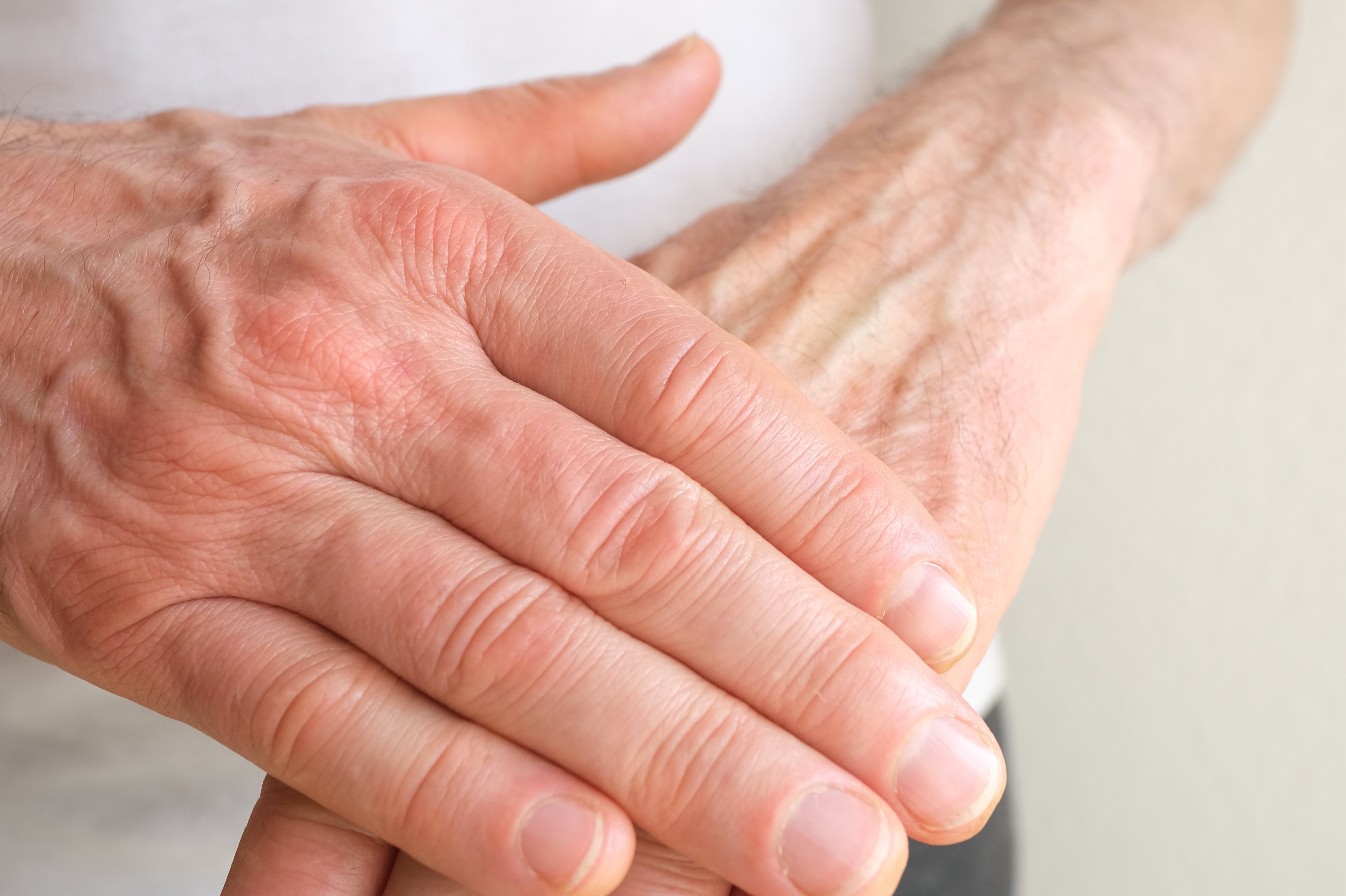 Copyright (c) 2022 Kittyfly/Shutterstock